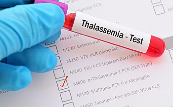 Committee created to monitor thalassemia fund